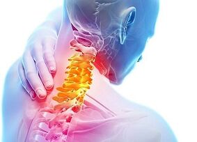 Przyczyny osteochondrozy szyjnej